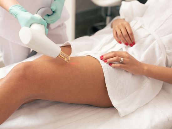 How To Get Rid Of Stretch Marks – Laser Therapy